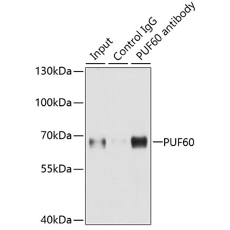 Western Blot - Anti-PUF60/FIR Antibody (A15340) - Antibodies.com