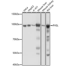 Western Blot - Anti-PYGL Antibody (A15341) - Antibodies.com