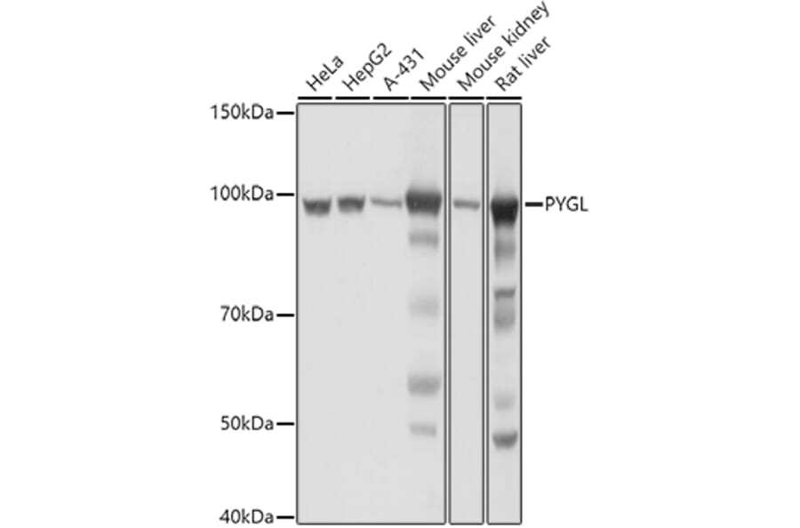 Western Blot - Anti-PYGL Antibody (A15341) - Antibodies.com