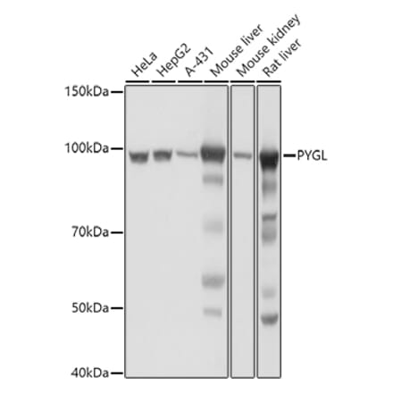 Western Blot - Anti-PYGL Antibody (A15341) - Antibodies.com