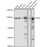 Western Blot - Anti-PYGL Antibody (A15341) - Antibodies.com