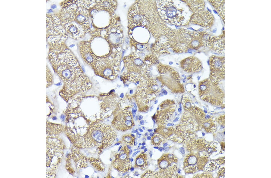 Immunohistochemistry - Anti-PYGL Antibody (A15341) - Antibodies.com