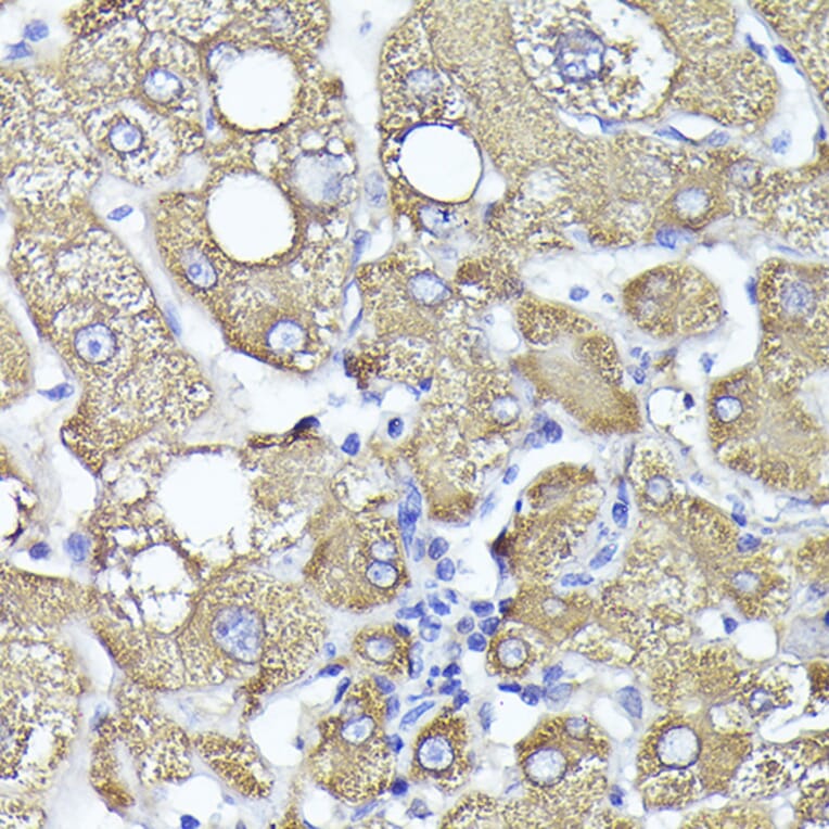 Immunohistochemistry - Anti-PYGL Antibody (A15341) - Antibodies.com