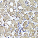 Immunohistochemistry - Anti-PYGL Antibody (A15341) - Antibodies.com