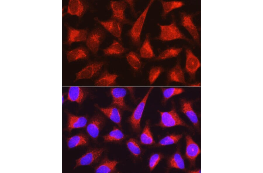 Immunofluorescence - Anti-PYGL Antibody (A15341) - Antibodies.com