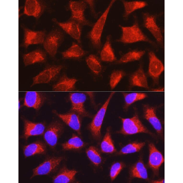 Immunofluorescence - Anti-PYGL Antibody (A15341) - Antibodies.com