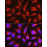 Immunofluorescence - Anti-PYGL Antibody (A15341) - Antibodies.com