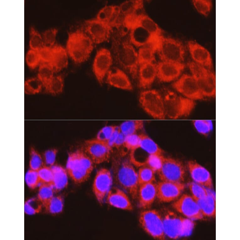 Immunofluorescence - Anti-PYGL Antibody (A15341) - Antibodies.com