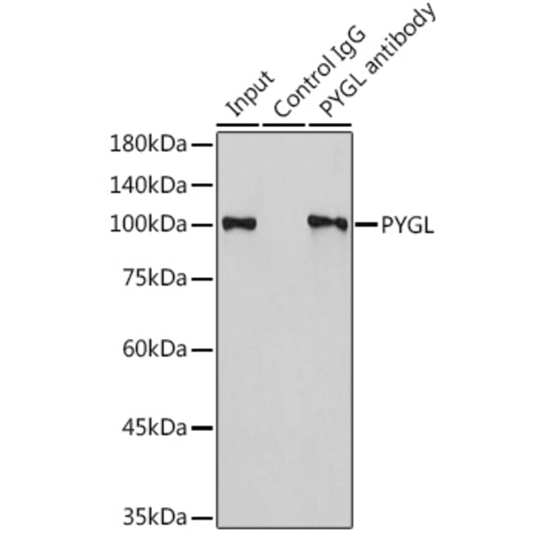 Western Blot - Anti-PYGL Antibody (A15341) - Antibodies.com