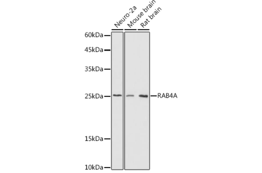 Western Blot - Anti-Rab4 Antibody (A15342) - Antibodies.com