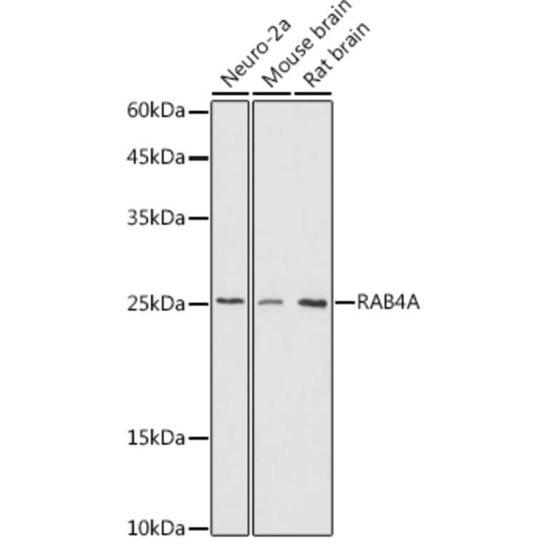 Western Blot - Anti-Rab4 Antibody (A15342) - Antibodies.com