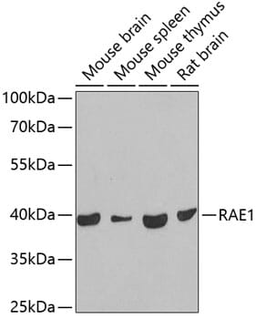 Western blot analysis of extracts of various cell lines, using Anti-RAE1 Antibody (A6713) at 1:1,000 dilution.
Secondary antibody: Goat Anti-Rabbit IgG (H+L) (HRP) (AS014) at 1:10,000 dilution.
Lysates / proteins: 25µg per lane.
Blocking buffer: 3% non-fat dry milk in TBST.
Detection: ECL Basic Kit (RM00020).
Exposure time: 10s.