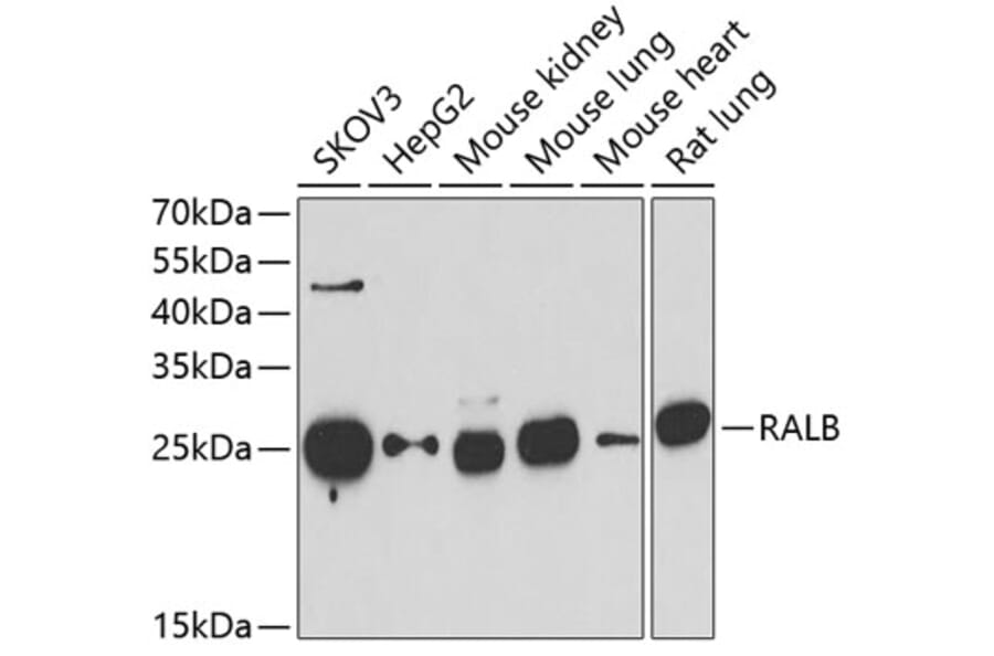 Western Blot - Anti-RALB Antibody (A15344) - Antibodies.com