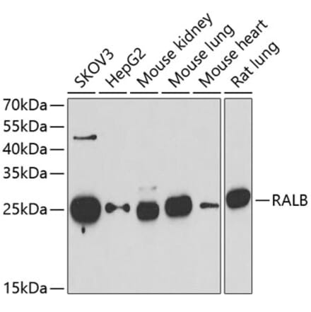 Western Blot - Anti-RALB Antibody (A15344) - Antibodies.com