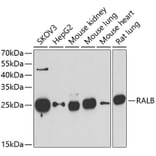 Western Blot - Anti-RALB Antibody (A15344) - Antibodies.com
