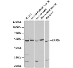 Western Blot - Anti-Rapsyn Antibody (A15345) - Antibodies.com