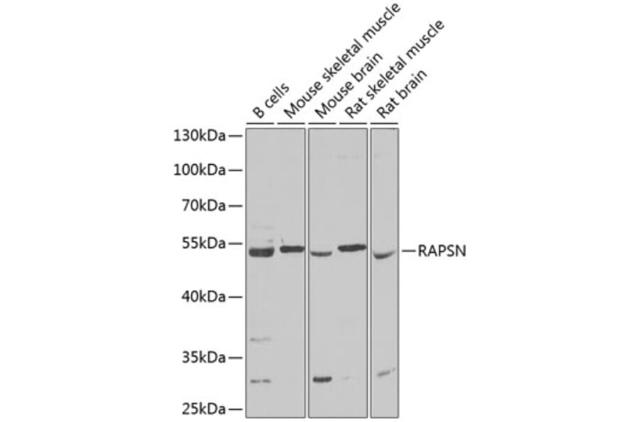 Western Blot - Anti-Rapsyn Antibody (A15345) - Antibodies.com