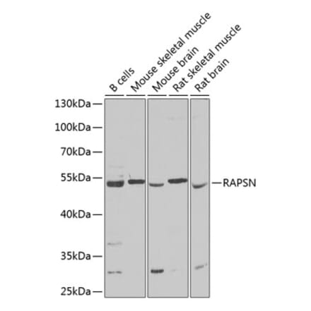 Western Blot - Anti-Rapsyn Antibody (A15345) - Antibodies.com