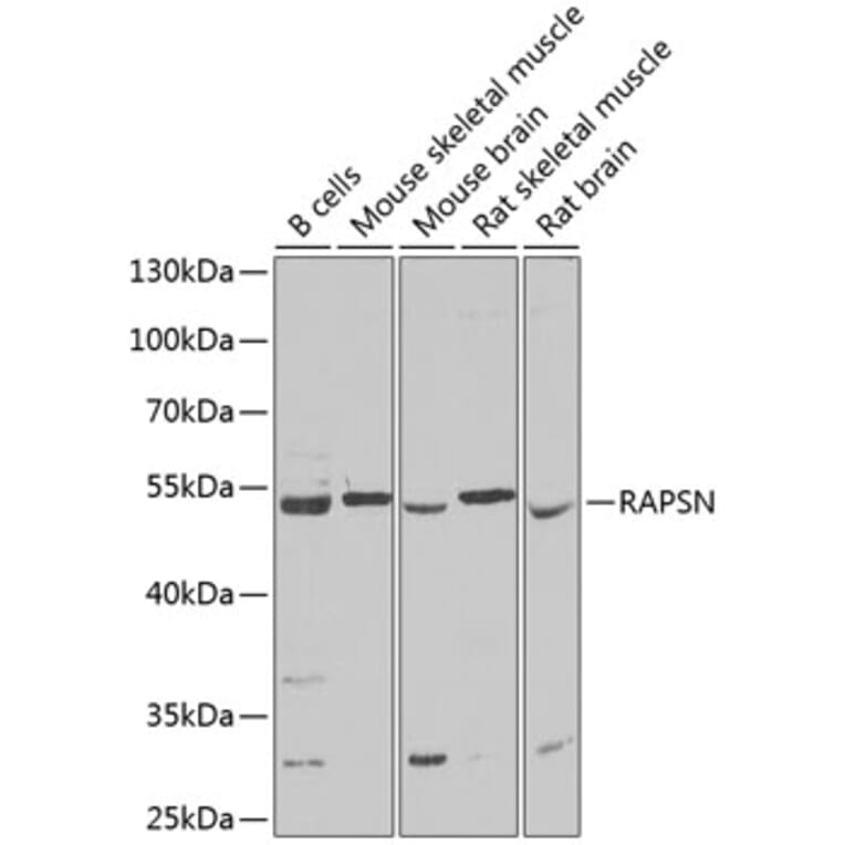 Western Blot - Anti-Rapsyn Antibody (A15345) - Antibodies.com
