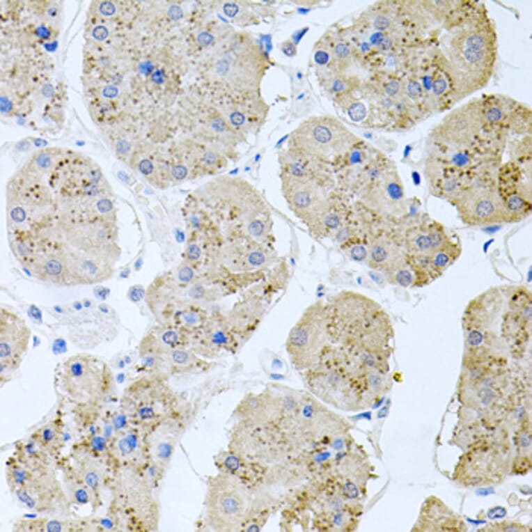 Immunohistochemistry - Anti-Rapsyn Antibody (A15345) - Antibodies.com