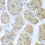 Immunohistochemistry - Anti-Rapsyn Antibody (A15345) - Antibodies.com