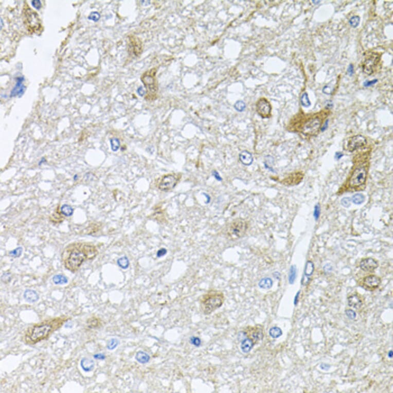 Immunohistochemistry - Anti-Rapsyn Antibody (A15345) - Antibodies.com