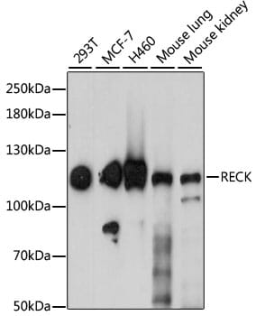 Western blot analysis of extracts of various cell lines, using Anti-RECK Antibody (A6718) at 1:1,000 dilution.
Secondary antibody: Goat Anti-Rabbit IgG (H+L) (HRP) (AS014) at 1:10,000 dilution.
Lysates / proteins: 25µg per lane.
Blocking buffer: 3% non-fat dry milk in TBST.
Detection: ECL Enhanced Kit (RM00021).
Exposure time: 60.