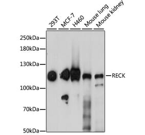 Western Blot - Anti-RECK Antibody (A15346) - Antibodies.com