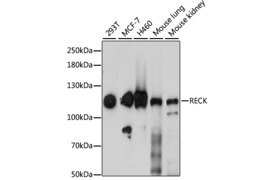 Western Blot - Anti-RECK Antibody (A15346) - Antibodies.com