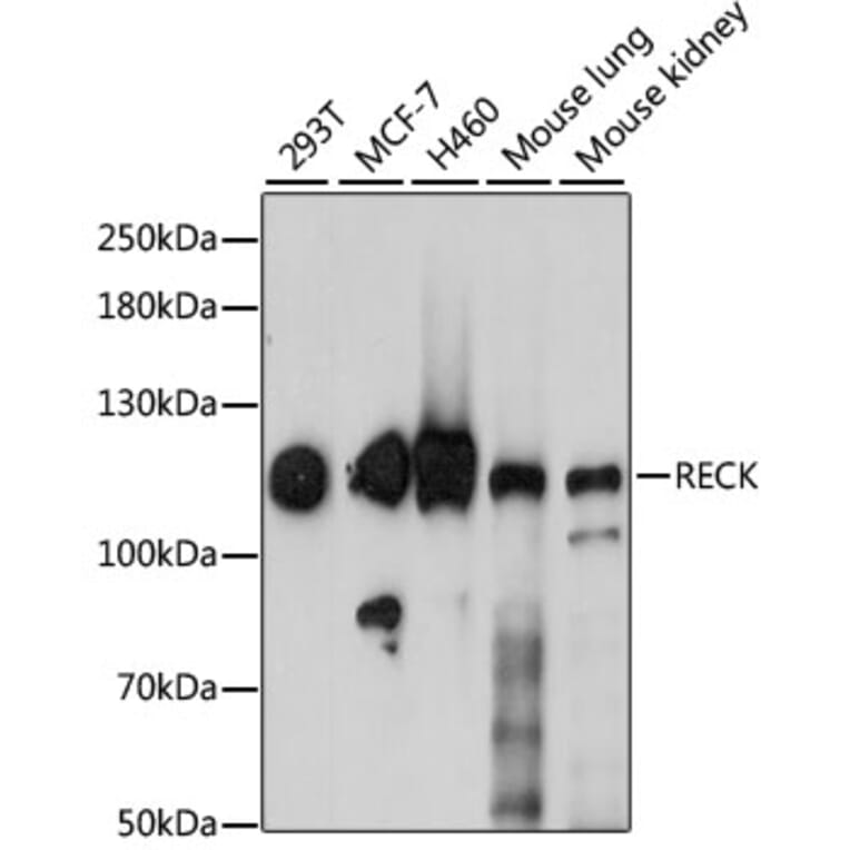 Western Blot - Anti-RECK Antibody (A15346) - Antibodies.com