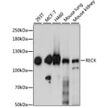 Western Blot - Anti-RECK Antibody (A15346) - Antibodies.com