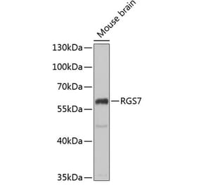 Western Blot - Anti-RGS7 Antibody (A15347) - Antibodies.com