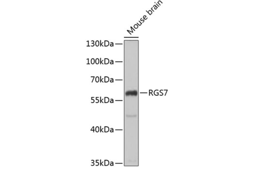 Western Blot - Anti-RGS7 Antibody (A15347) - Antibodies.com