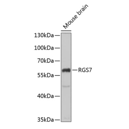 Western Blot - Anti-RGS7 Antibody (A15347) - Antibodies.com