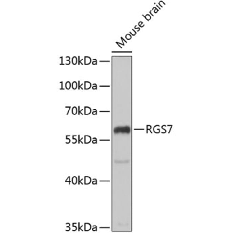 Western Blot - Anti-RGS7 Antibody (A15347) - Antibodies.com