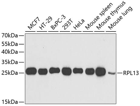 Western blot analysis of extracts of various cell lines, using Anti-RPL13 Antibody (A6723) at 1:1,000 dilution.
Secondary antibody: Goat Anti-Rabbit IgG (H+L) (HRP) (AS014) at 1:10,000 dilution.
Lysates / proteins: 25µg per lane.
Blocking buffer: 3% non-fat dry milk in TBST.
Detection: ECL Basic Kit (RM00020).
Exposure time: 1s.