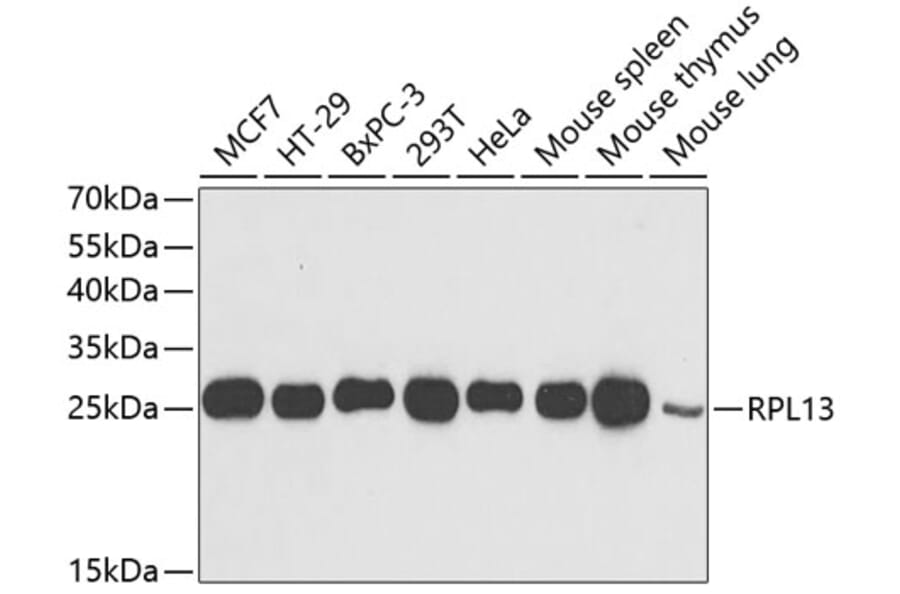 Western Blot - Anti-RPL13 Antibody (A15348) - Antibodies.com