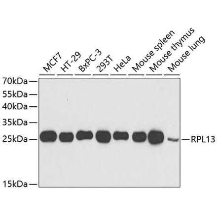 Western Blot - Anti-RPL13 Antibody (A15348) - Antibodies.com