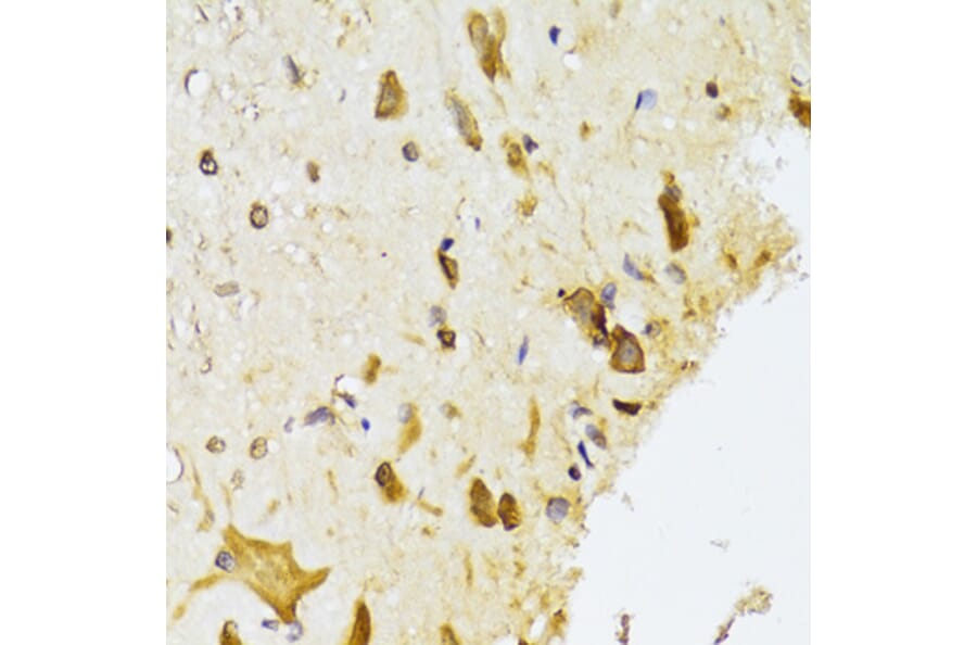 Immunohistochemistry - Anti-RPL13 Antibody (A15348) - Antibodies.com