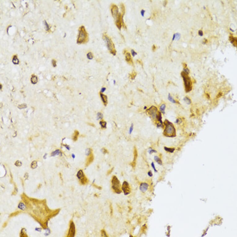 Immunohistochemistry - Anti-RPL13 Antibody (A15348) - Antibodies.com