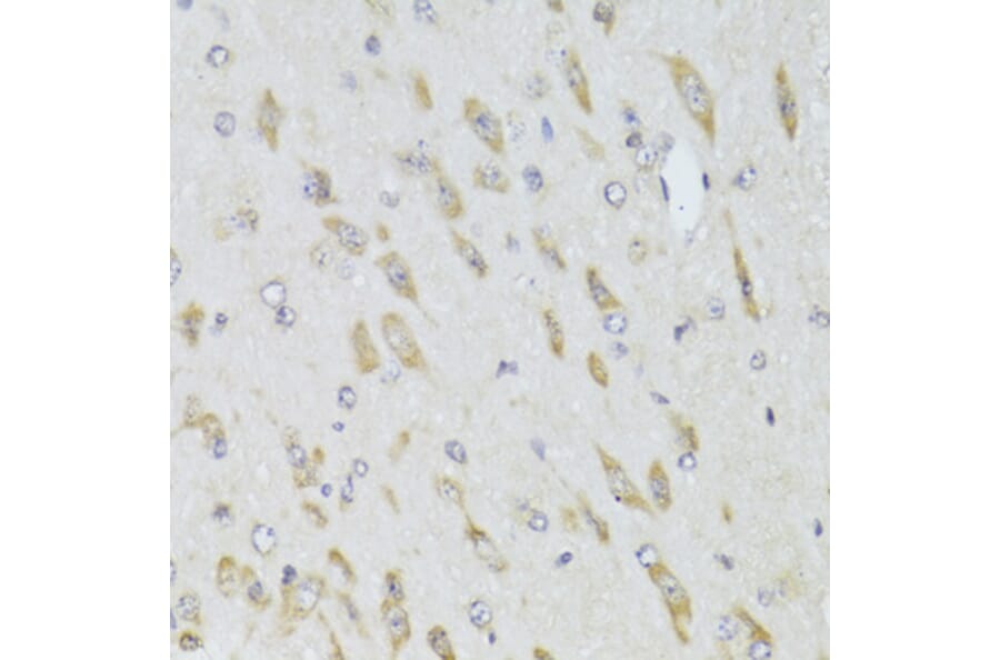Immunohistochemistry - Anti-RPL13 Antibody (A15348) - Antibodies.com