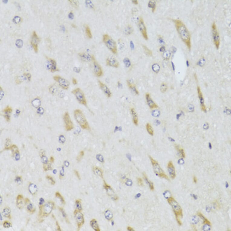 Immunohistochemistry - Anti-RPL13 Antibody (A15348) - Antibodies.com