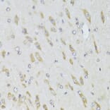 Immunohistochemistry - Anti-RPL13 Antibody (A15348) - Antibodies.com