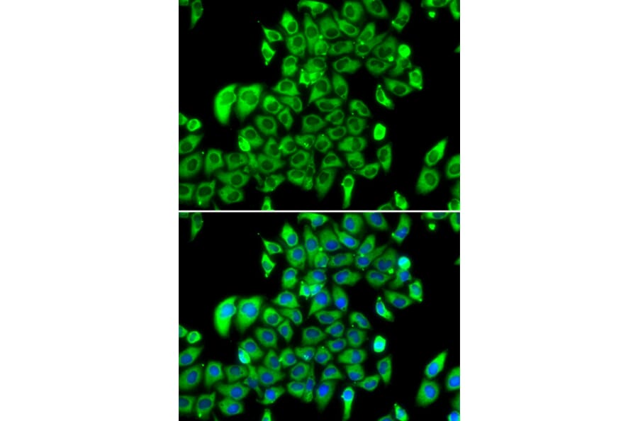 Immunofluorescence - Anti-RPL13 Antibody (A15348) - Antibodies.com