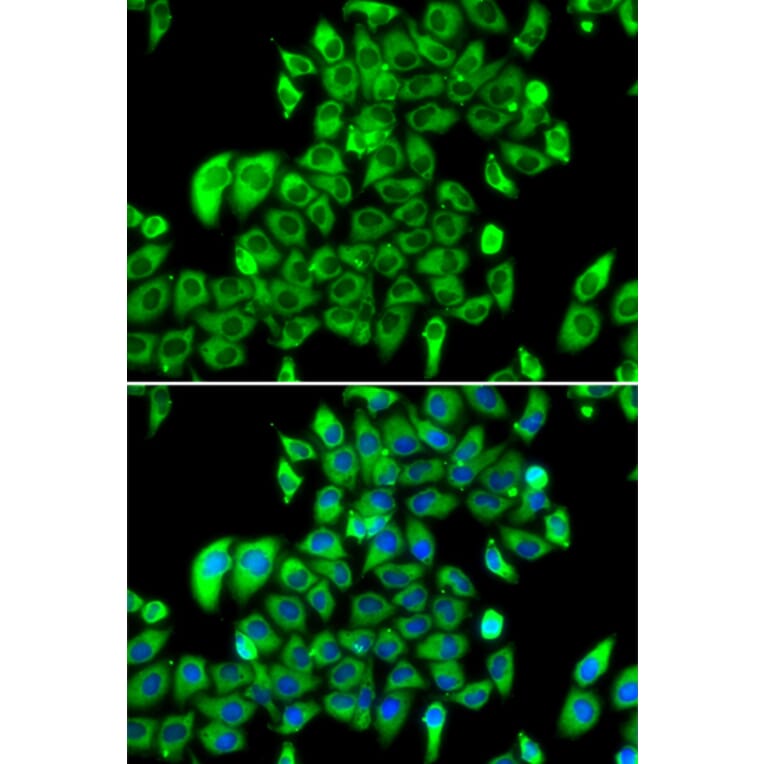Immunofluorescence - Anti-RPL13 Antibody (A15348) - Antibodies.com