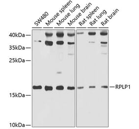 Western Blot - Anti-RPLP1 Antibody (A15349) - Antibodies.com