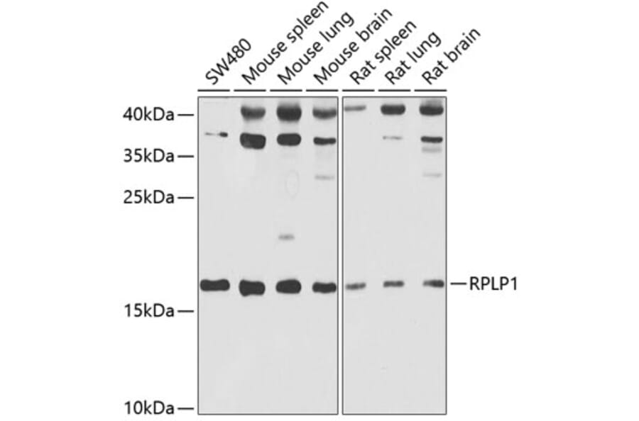 Western Blot - Anti-RPLP1 Antibody (A15349) - Antibodies.com