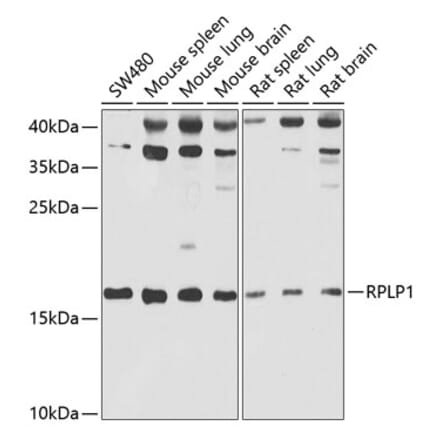 Western Blot - Anti-RPLP1 Antibody (A15349) - Antibodies.com