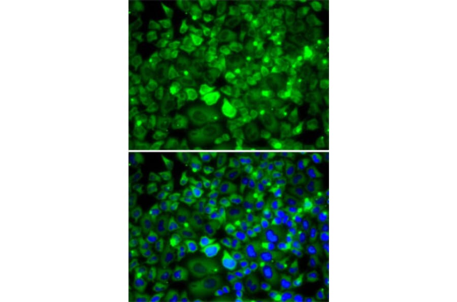 Immunofluorescence - Anti-RPLP1 Antibody (A15349) - Antibodies.com