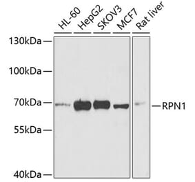 Western Blot - Anti-Ribophorin I Antibody (A15350) - Antibodies.com